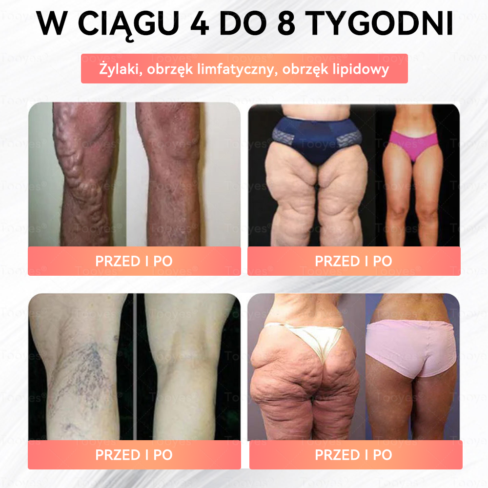 ⚡Oficjalny Autoryzowany Sklep – Tooyes® GLP-1 Perły z wysoko skoncentrowanym serum – NAD+, Moringa i HCA — skuteczna formuła dla Twojego ciała i zdrowia. Stworzone przez specjalistów, którym możesz zaufać.