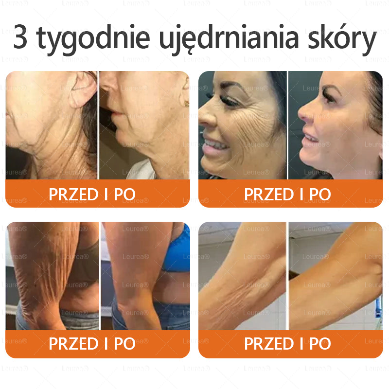 ✨Leurea® Krem Regenerujący z Jadem Pszczelim - Naturalna regeneracja skóry, wygładzenie zmarszczek i promienna cera-50 ml