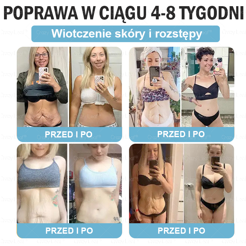 🔥Klinicznie potwierdzone | Oficjalny sklep | CrazyLeaf® Szczupłość i Witalność Tirzepatide – doustny roztwór wspierający odchudzanie, ciśnienie i poziom cukru