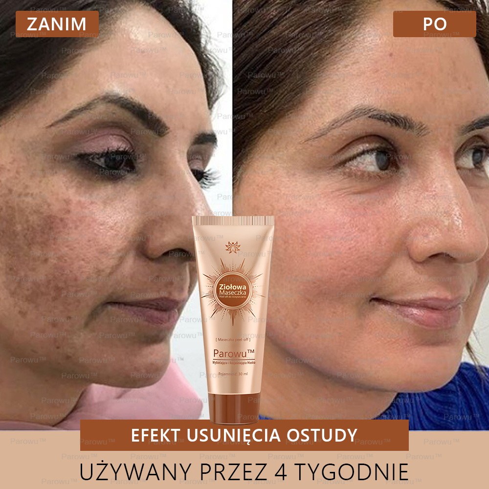 Parowu™ Wybielająca i Rozjaśniająca Maska - Naturalne składniki trwale usuwają plamy, piegi i przebarwienia