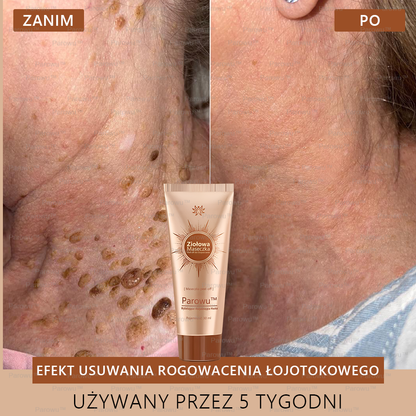 Parowu™ Wybielająca i Rozjaśniająca Maska - Naturalne składniki trwale usuwają plamy, piegi i przebarwienia