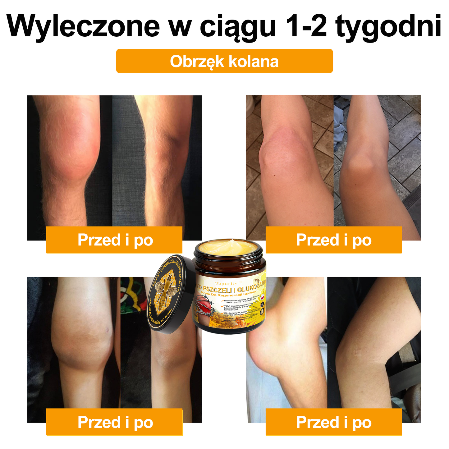 Gbpurity™ Krem Do Regeneracji Stawów | 🛡️ Dla osób w średnim i późnym wieku