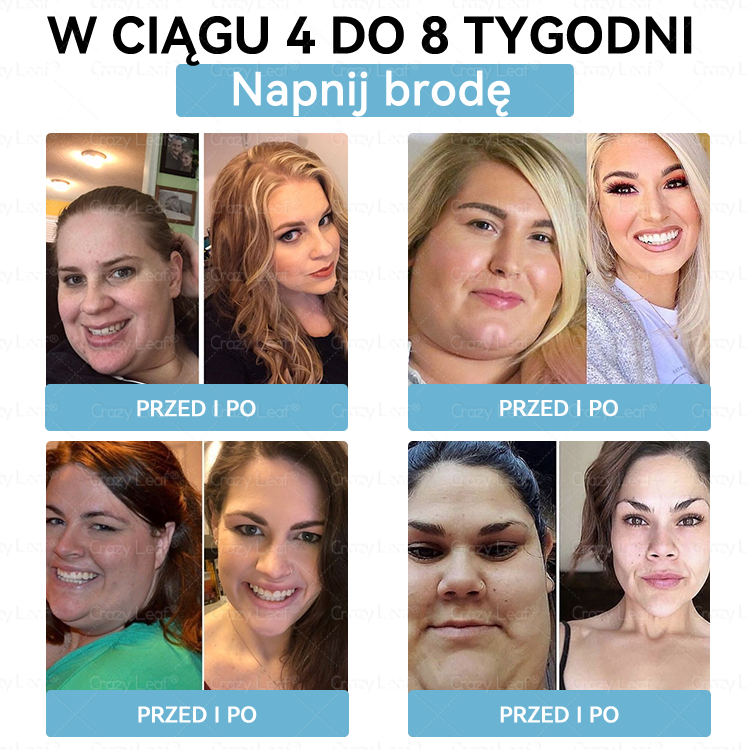 🔥Klinicznie potwierdzone | Oficjalny sklep | CrazyLeaf® Szczupłość i Witalność Tirzepatide – doustny roztwór wspierający odchudzanie, ciśnienie i poziom cukru