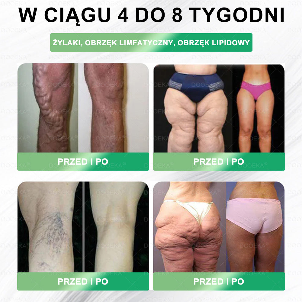 DOOEKA® GLP-1 8 w 1 Fit & Vital roztwór doustny 💚 Raz dziennie, widoczne zmiany w ciągu 7 dni / W przypadku otyłości, zdrowia serca i układu krążenia, cukrzycy, bezdechu sennego, zdrowia jelit, problemów ze stawami i wielu innych
