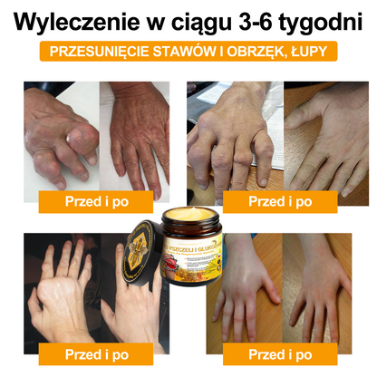 Gbpurity™ Krem Do Regeneracji Stawów | 🛡️ Dla osób w średnim i późnym wieku