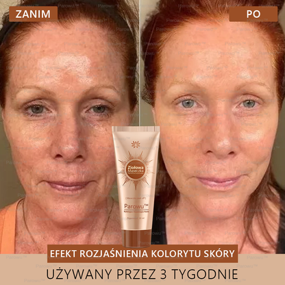 Parowu™ Wybielająca i Rozjaśniająca Maska - Naturalne składniki trwale usuwają plamy, piegi i przebarwienia