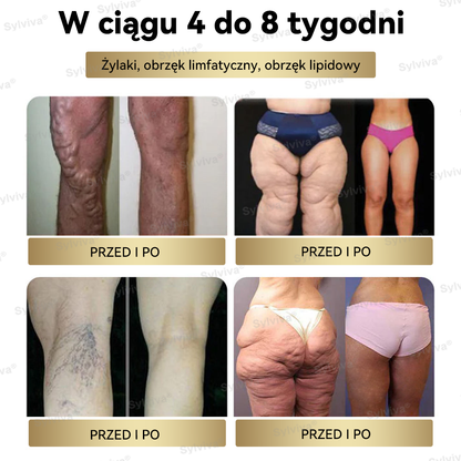 🔥Polecane przez Klinikę Mayo | Oficjalny sklep | Sylviva® GLP-1 Moringa – krople na odchudzanie i zdrowie 🔥 (Spalacz tłuszczu o jakości spożywczej – opracowany przez Towarzystwo Otyłości)