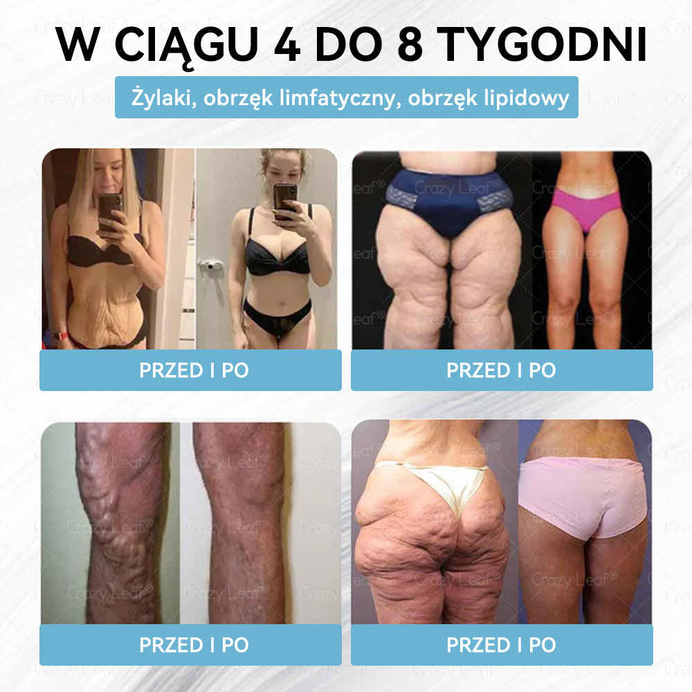 🔥Klinicznie potwierdzone | Oficjalny sklep | CrazyLeaf® Szczupłość i Witalność Tirzepatide – doustny roztwór wspierający odchudzanie, ciśnienie i poziom cukru